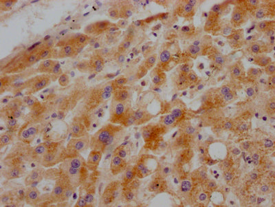 GHR Antibody – Figure 1 of 3