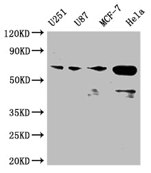 Western Blot
Positive WB detected in: U251 whole cell lysate, U87 whole cell lysate, MCF-7 whole cell lysate, Hela whole cell lysate
All lanes: STK3 antibody at 1:2000
Secondary
Goat polyclonal to rabbit IgG at 1/50000 dilution
Predicted band size: 57, 60 kDa
Observed band size: 50-70 kDa