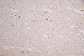 IHC image of CSB-RA980583A0HU diluted at 1:50 and staining in paraffin-embedded human brain tissue performed on a Leica BondTM system. After dewaxing and hydration, antigen retrieval was mediated by high pressure in a citrate buffer (pH 6.0) . Section was blocked with 10% normal goat serum 30min at RT. Then primary antibody (1% BSA) was incubated at 4°C overnight. The primary is detected by a Goat anti-rabbit polymer IgG labeled by HRP and visualized using 0.57% DAB.