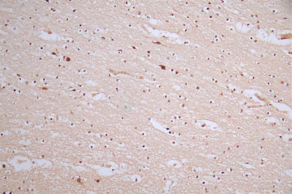 IHC image of CSB-RA980583A0HU diluted at 1:50 and staining in paraffin-embedded human brain tissue performed on a Leica BondTM system. After dewaxing and hydration, antigen retrieval was mediated by high pressure in a citrate buffer (pH 6.0) . Section was blocked with 10% normal goat serum 30min at RT. Then primary antibody (1% BSA) was incubated at 4°C overnight. The primary is detected by a Goat anti-rabbit polymer IgG labeled by HRP and visualized using 0.57% DAB.