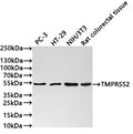 Western Blot
Positive WB detected in: PC-3 whole cell lysate(30µg) , HT-29 whole cell lysate(30µg) , NIH/3T3 whole cell lysate(30µg) , Rat colorectal tissue lysate(30µg) 
All lanes: TMPRSS2 antibody at 1:1000
Secondary
Goat polyclonal to rabbit IgG at 1/40000 dilution
Predicted band size: 54 kDa
Observed band size: 54 kDa
Exposure time：3min