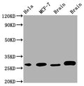 Western Blot
Positive WB detected in: Hela whole cell lysate, MCF-7 whole cell lysate, Mouse Brain whole cell lysate, Rat Brain whole cell lysate
All lanes: GRB2 antibody at 1:1000
Secondary
Goat polyclonal to rabbit IgG at 1/50000 dilution
Predicted band size: 26, 21 kDa
Observed band size: 28 kDa