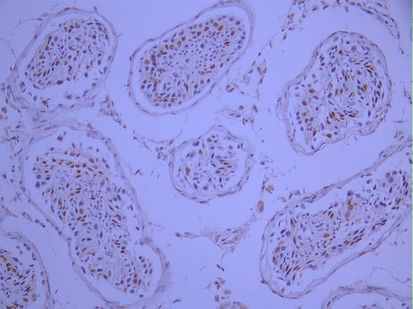 IHC image of CSB-RA981712A0HU diluted at 1:100 and staining in paraffin-embedded human testis tissue performed on a Leica BondTM system. After dewaxing and hydration, antigen retrieval was mediated by high pressure in a citrate buffer (pH 6.0). Section was blocked with 10% normal goat serum 30min at RT. Then primary antibody (1% BSA) was incubated at 4°C overnight. The primary is detected by a Goat anti-rabbit polymer IgG labeled by HRP and visualized using 0.05% DAB.