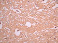 IHC image of CSB-RA981854A0HU diluted at 1:100 and staining in paraffin-embedded human brain tissue performed on a Leica BondTM system. After dewaxing and hydration, antigen retrieval was mediated by high pressure in a citrate buffer (pH 6.0). Section was blocked with 10% normal goat serum 30min at RT. Then primary antibody (1% BSA) was incubated at 4°C overnight. The primary is detected by a Goat anti-rabbit polymer IgG labeled by HRP and visualized using 0.05% DAB.