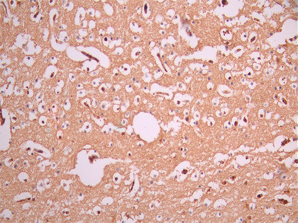 IHC image of CSB-RA981854A0HU diluted at 1:100 and staining in paraffin-embedded human brain tissue performed on a Leica BondTM system. After dewaxing and hydration, antigen retrieval was mediated by high pressure in a citrate buffer (pH 6.0). Section was blocked with 10% normal goat serum 30min at RT. Then primary antibody (1% BSA) was incubated at 4°C overnight. The primary is detected by a Goat anti-rabbit polymer IgG labeled by HRP and visualized using 0.05% DAB.