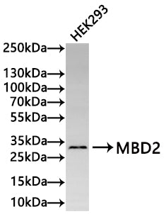 Western Blot
Positive WB detected in: HEK293 whole cell lysate(30µg) 
All lanes: MBD2 antibody at 1:1000
Secondary
Goat polyclonal to rabbit IgG at 1/50000 dilution
Predicted band size: 43 kDa
Observed band size: 29 kDa
Exposure time: 3min
