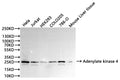 Western Blot
Positive WB detected in: Hela whole cell lysate(30µg), Jurkat whole cell lysate(30µg), HEK293 whole cell lysate(30µg), COLO205 whole cell lysate(30µg), 786-O whole cell lysate(30µg), Mouse liver tissue lysate(30µg)
All lanes:Adenylate kinase 4 antibody at 1:1000
Secondary
Goat polyclonal to rabbit IgG at 1/40000 dilution
Predicted band size: 25 kDa
Observed band size: 26 kDa
Exposure time：2min