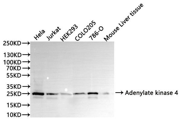 Western Blot
Positive WB detected in: Hela whole cell lysate(30µg), Jurkat whole cell lysate(30µg), HEK293 whole cell lysate(30µg), COLO205 whole cell lysate(30µg), 786-O whole cell lysate(30µg), Mouse liver tissue lysate(30µg)
All lanes:Adenylate kinase 4 antibody at 1:1000
Secondary
Goat polyclonal to rabbit IgG at 1/40000 dilution
Predicted band size: 25 kDa
Observed band size: 26 kDa
Exposure time：2min