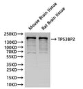 Western Blot, 
Positive WB detected in:Mouse brain tissue lysate(30µg), Rat brain lysate(30µg)
All lanes:TP53BP2 antibody at 1:1000
Secondary
Goat polyclonal to rabbit IgG at 1/40000 dilution
Predicted band size: 126 kDa
Observed band size: 150 kDa
Exposure time：10s