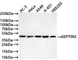 Western Blot
Positive WB detected in: PC-3 whole cell lysate(30µg) , HeLa whole cell lysate(30µg) , A549 whole cell lysate, A-431 whole cell lysate(30µg) , HEK293 whole cell lysate(30µg) 
All lanes: SEPTIN2 antibody at 1:1000
Secondary
Goat polyclonal to rabbit IgG at 1/50000 dilution
Predicted band size: 41 kDa
Observed band size: 41 kDa
Exposure time: 2min