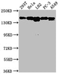 Western Blot
Positive WB detected in: 293T whole cell lysate, Hela whole cell lysate, L02 whole cell lysate, PC-3 whole cell lysate, A549 whole cell lysate
All lanes: MET antibody at 1:1500
Secondary
Goat polyclonal to rabbit IgG at 1/50000 dilution
Predicted band size: 156, 158, 86 kDa
Observed band size: 156 kDa
