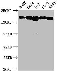 Western Blot
Positive WB detected in: 293T whole cell lysate, Hela whole cell lysate, L02 whole cell lysate, PC-3 whole cell lysate, A549 whole cell lysate
All lanes: MET antibody at 1:1500
Secondary
Goat polyclonal to rabbit IgG at 1/50000 dilution
Predicted band size: 156, 158, 86 kDa
Observed band size: 156 kDa