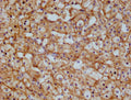IHC image of CSB-RA983422A0HU diluted at 1:100 and staining in paraffin-embedded  human adrenal gland tissue performed on a Leica BondTM system. After dewaxing and hydration, antigen retrieval was mediated by high pressure in a citrate buffer (pH 6.0) . Section was blocked with 10% normal goat serum 30min at RT. Then primary antibody (1% BSA) was incubated at 4°C overnight. The primary is detected by a Goat anti-rabbit polymer IgG labeled by HRP and visualized using 0.05% DAB.