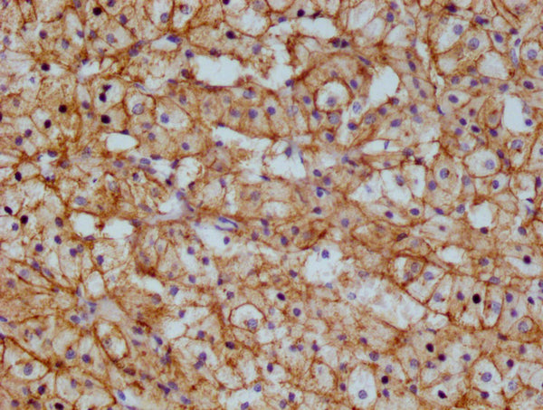 IHC image of CSB-RA983422A0HU diluted at 1:100 and staining in paraffin-embedded  human adrenal gland tissue performed on a Leica BondTM system. After dewaxing and hydration, antigen retrieval was mediated by high pressure in a citrate buffer (pH 6.0) . Section was blocked with 10% normal goat serum 30min at RT. Then primary antibody (1% BSA) was incubated at 4°C overnight. The primary is detected by a Goat anti-rabbit polymer IgG labeled by HRP and visualized using 0.05% DAB.