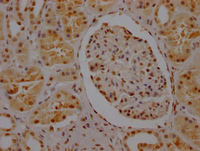 IHC image of CSB-RA984434A0HU diluted at 1:100 and staining in paraffin-embedded human kidney tissue performed on a Leica BondTM system. After dewaxing and hydration, antigen retrieval was mediated by high pressure in a citrate buffer (pH 6.0) . Section was blocked with 10% normal goat serum 30min at RT. Then primary antibody (1% BSA) was incubated at 4℃ overnight. The primary is detected by a Goat anti-rabbit IgG polymer labeled by HRP and visualized using 0.05% DAB.