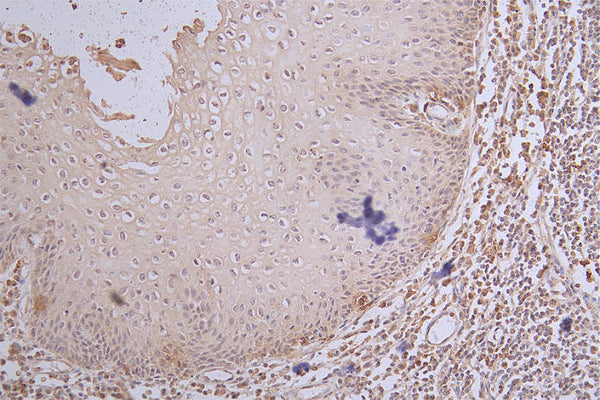 IHC image of CSB-RA984483A0HU diluted at 1:100 and staining in paraffin-embedded human tonsil tissue performed on a Leica BondTM system. After dewaxing and hydration, antigen retrieval was mediated by high pressure in a citrate buffer (pH 6.0) . Section was blocked with 10% normal goat serum 30min at RT. Then primary antibody (1% BSA) was incubated at 4°C overnight. The primary is detected by a Goat anti-rabbit polymer IgG labeled by HRP and visualized using 0.65% DAB.