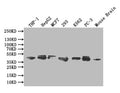 Western Blot
Positive WB detected in: THP-1 whole cell lysate, HEPG2 whole cell lysate,MCF7 whole cell lysate,293 whole cell lysate,K562 whole cell lysate,PC-3 whole cell lysate, Mouse brain tissue lysate
All lanes: ERK1/2 antibody at 1:1000
Secondary
Goat polyclonal to rabbit IgG at 1/50000 dilution
Predicted band size: 42,44 kDa
Observed band size: 42,44 kDa