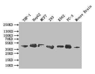Western Blot
Positive WB detected in: THP-1 whole cell lysate, HEPG2 whole cell lysate,MCF7 whole cell lysate,293 whole cell lysate,K562 whole cell lysate,PC-3 whole cell lysate, Mouse brain tissue lysate
All lanes: ERK1/2 antibody at 1:1000
Secondary
Goat polyclonal to rabbit IgG at 1/50000 dilution
Predicted band size: 42,44 kDa
Observed band size: 42,44 kDa