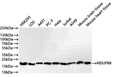 Western Blot
Positive WB detected in: HEK293 whole cell lysate(30µg) , LO2 whole cell lysate(30µg) , A431 whole cell lysate(30µg) , PC-3 whole cell lysate(30µg) , Hela whole cell lysate(30µg) , JURKAT whole cell lysate(30µg) , A549 whole cell lysate(30µg) , Mouse brain tissue lysate(30µg) , Mouse heart tissue lysate(30µg) 
All lanes: NDUFB8 antibody at 1:1000
Secondary
Goat polyclonal to rabbit IgG at 1/40000 dilution
Predicted band size: 22 kDa
Observed band size: 19 kDa
Exposure time：20s