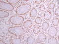 IHC image of CSB-RA986010A0HU diluted at 1:100 and staining in paraffin-embedded human small intestine tissue performed on a Leica BondTM system. After dewaxing and hydration, antigen retrieval was mediated by high pressure in a citrate buffer (pH 6.0) . Section was blocked with 10% normal goat serum 30min at RT. Then primary antibody (1% BSA) was incubated at 4°C overnight. The primary is detected by a Goat anti-rabbit polymer IgG labeled by HRP and visualized using 0.05% DAB.