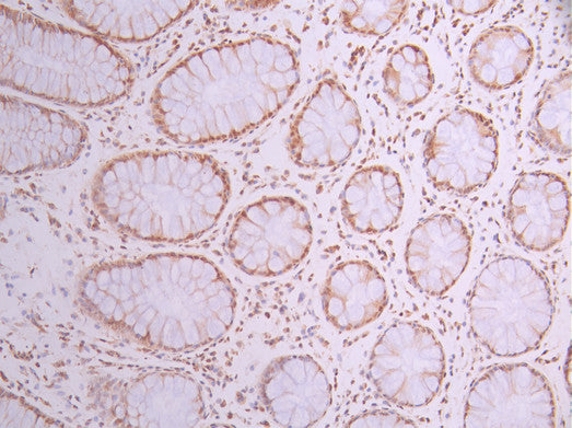 IHC image of CSB-RA986010A0HU diluted at 1:100 and staining in paraffin-embedded human small intestine tissue performed on a Leica BondTM system. After dewaxing and hydration, antigen retrieval was mediated by high pressure in a citrate buffer (pH 6.0) . Section was blocked with 10% normal goat serum 30min at RT. Then primary antibody (1% BSA) was incubated at 4°C overnight. The primary is detected by a Goat anti-rabbit polymer IgG labeled by HRP and visualized using 0.05% DAB.