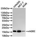 Western Blot
Positive WB detected in: COLO205 whole cell lysate(30µg) , MCF-7 whole cell lysate(30µg) , A549 whole cell lysate(30µg) 
All lanes: AGR2 antibody at 1:1000
Secondary
Goat polyclonal to rabbit IgG at 1/50000 dilution
Predicted band size: 20 kDa
Observed band size: 17 kDa
Exposure time: 2min