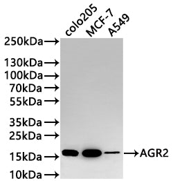 Western Blot
Positive WB detected in: COLO205 whole cell lysate(30µg) , MCF-7 whole cell lysate(30µg) , A549 whole cell lysate(30µg) 
All lanes: AGR2 antibody at 1:1000
Secondary
Goat polyclonal to rabbit IgG at 1/50000 dilution
Predicted band size: 20 kDa
Observed band size: 17 kDa
Exposure time: 2min