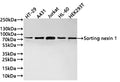Western Blot
Positive WB detected in:  HT-29 whole cell lysate(30µg) , A431 whole cell lysate(30µg) , Jurkat whole cell lysate(30µg) , HL-60 whole cell lysate(30µg) , HEK293T whole cell lysate(30µg) 
All lanes: Sorting nexin 1 antibody at 1:1000
Secondary
Goat polyclonal to rabbit IgG at 1/40000 dilution
Predicted band size: 59 kDa
Observed band size: 74 kDa
Exposure time：2min