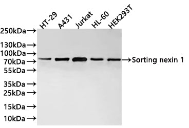 Western Blot
Positive WB detected in:  HT-29 whole cell lysate(30µg) , A431 whole cell lysate(30µg) , Jurkat whole cell lysate(30µg) , HL-60 whole cell lysate(30µg) , HEK293T whole cell lysate(30µg) 
All lanes: Sorting nexin 1 antibody at 1:1000
Secondary
Goat polyclonal to rabbit IgG at 1/40000 dilution
Predicted band size: 59 kDa
Observed band size: 74 kDa
Exposure time：2min