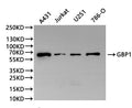 Western Blot, 
Positive WB detected in:A431 whole cell lysate(30µg), Jurkat whole cell lysate(30µg), U251 whole cell lysate(30µg), 786-O whole cell lysate(30µg)
All lanes: GBP1 antibody at 1:1000
Secondary
Goat polyclonal to rabbit IgG at 1/40000 dilution
Predicted band size: 68 kDa
Observed band size: 68 kDa
Exposure time：120s