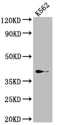 Western Blot
Positive WB detected in: K562 whole cell lysate
All lanes: SAE1 Antibody at 1:1000
Secondary
Goat polyclonal to rabbit IgG at 1/50000 dilution
Predicted band size: 39, 30, 34 kDa
Observed band size: 39 kDa