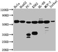 Western Blot
Positive WB detected in: Hela whole cell lysate, HepG2 whole cell lysate, PC-3 whole cell lysate, K562 whole cell lysate, HL-60 whole cell lysate, MCF-7 whole cell lysate, Jurkat whole cell lysate
All lanes: PTBP1 antibody at 1:1000
Secondary
Goat polyclonal to rabbit IgG at 1/50000 dilution
Predicted band size: 58, 60, 60 kDa
Observed band size: 58 kDa