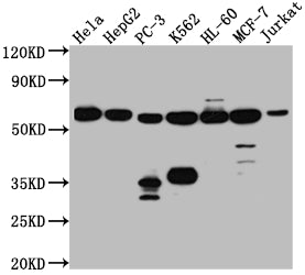 Western Blot
Positive WB detected in: Hela whole cell lysate, HepG2 whole cell lysate, PC-3 whole cell lysate, K562 whole cell lysate, HL-60 whole cell lysate, MCF-7 whole cell lysate, Jurkat whole cell lysate
All lanes: PTBP1 antibody at 1:1000
Secondary
Goat polyclonal to rabbit IgG at 1/50000 dilution
Predicted band size: 58, 60, 60 kDa
Observed band size: 58 kDa