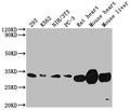 Western Blot
Positive WB detected in: 293 whole cell lysate, K562 whole cell lysate, NIH/3T3 whole cell lysate, PC-3 whole cell lysate, Rat heart tissue, Mouse heart tissue, Mouse liver tissue
All lanes: SDHB antibody at 1:2000
Secondary
Goat polyclonal to rabbit IgG at 1/50000 dilution
Predicted band size: 32 kDa
Observed band size: 32 kDa