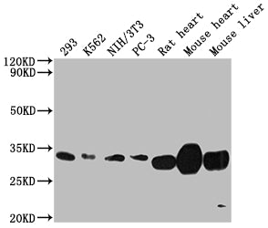 Western Blot
Positive WB detected in: 293 whole cell lysate, K562 whole cell lysate, NIH/3T3 whole cell lysate, PC-3 whole cell lysate, Rat heart tissue, Mouse heart tissue, Mouse liver tissue
All lanes: SDHB antibody at 1:2000
Secondary
Goat polyclonal to rabbit IgG at 1/50000 dilution
Predicted band size: 32 kDa
Observed band size: 32 kDa