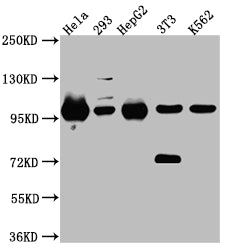 Western Blot
Positive WB detected in: Hela whole cell lysate, 293 whole cell lysate, HepG2 whole cell lysate, NIH/3T3 whole cell lysate, K562 whole cell lysate
All lanes: STAT6 Antibody at 1:1000
Secondary
Goat polyclonal to rabbit IgG at 1/50000 dilution
Predicted band size: 95, 75, 82 kDa
Observed band size: 100 kDa