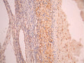 IHC image of CSB-RA989447A0HU diluted at 1:100 and staining in paraffin-embedded human kidney tissue上腺 performed on a Leica BondTM system. After dewaxing and hydration, antigen retrieval was mediated by high pressure in a citrate buffer (pH 6.0). Section was blocked with 10% normal goat serum 30min at RT. Then primary antibody (1% BSA) was incubated at 4°C overnight. The primary is detected by a Goat anti-rabbit polymer IgG labeled by HRP and visualized using 0.05% DAB.