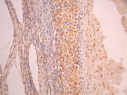 IHC image of CSB-RA989447A0HU diluted at 1:100 and staining in paraffin-embedded human kidney tissue上腺 performed on a Leica BondTM system. After dewaxing and hydration, antigen retrieval was mediated by high pressure in a citrate buffer (pH 6.0). Section was blocked with 10% normal goat serum 30min at RT. Then primary antibody (1% BSA) was incubated at 4°C overnight. The primary is detected by a Goat anti-rabbit polymer IgG labeled by HRP and visualized using 0.05% DAB.