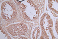 IHC image of CSB-RA989713A0HU diluted at 1:50 and staining in paraffin-embedded human testis tissue performed on a Leica BondTM system. After dewaxing and hydration, antigen retrieval was mediated by high pressure in a citrate buffer (pH 6.0) . Section was blocked with 10% normal goat serum 30min at RT. Then primary antibody (1% BSA) was incubated at 4°C overnight. The primary is detected by a Goat anti-rabbit polymer IgG labeled by HRP and visualized using 0.40% DAB.