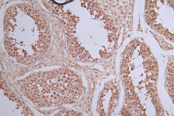 IHC image of CSB-RA989713A0HU diluted at 1:50 and staining in paraffin-embedded human testis tissue performed on a Leica BondTM system. After dewaxing and hydration, antigen retrieval was mediated by high pressure in a citrate buffer (pH 6.0) . Section was blocked with 10% normal goat serum 30min at RT. Then primary antibody (1% BSA) was incubated at 4°C overnight. The primary is detected by a Goat anti-rabbit polymer IgG labeled by HRP and visualized using 0.40% DAB.