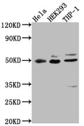 Western Blot
Positive WB detected in: Hela whole cell lysate, HEK293 whole cell lysate, THP-1 whole cell lysate
All lanes: MAPKAPK2 antibody at 1:1000
Secondary
Goat polyclonal to rabbit IgG at 1/50000 dilution
Predicted band size: 46, 43 kDa
Observed band size: 49 kDa