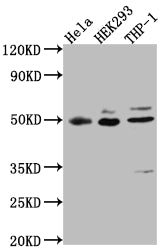Western Blot
Positive WB detected in: Hela whole cell lysate, HEK293 whole cell lysate, THP-1 whole cell lysate
All lanes: MAPKAPK2 antibody at 1:1000
Secondary
Goat polyclonal to rabbit IgG at 1/50000 dilution
Predicted band size: 46, 43 kDa
Observed band size: 49 kDa