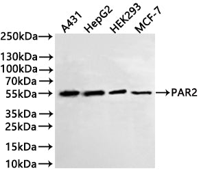 Western Blot
Positive WB detected in: A431 whole cell lysate(30µg) , HepG2 whole cell lysate(30µg) , HEK293 whole cell lysate(30µg) , MCF-7 whole cell lysate(30µg) 
All lanes: PAR2 antibody at 1:1000
Secondary
Goat polyclonal to rabbit IgG at 1/40000 dilution
Predicted band size: 44 kDa
Observed band size: 55 kDa
Exposure time：3min