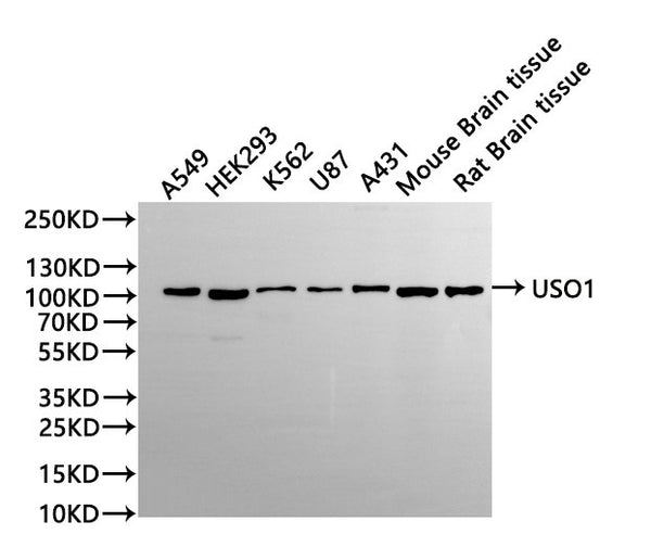 Western Blot
Positive WB detected in: A549 whole cell lysate(30µg), HEK293 whole cell lysate(30µg), K562 whole cell lysate(30µg), U-87MG whole cell lysate(30µg), A431 whole cell lysate(30µg), Mouse brain tissue lysate(30µg), Rat brain tissue lysate(30µg)
All lanes: USO1 antibody at 1:1000
Secondary
Goat polyclonal to rabbit IgG at 1/40000 dilution
Predicted band size: 108 kDa
Observed band size: 108 kDa
Exposure time：2min