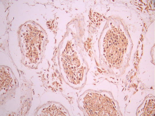 IHC image of CSB-RA990431A0HU diluted at 1:100 and staining in paraffin-embedded human testis tissue performed on a Leica BondTM system. After dewaxing and hydration, antigen retrieval was mediated by high pressure in a citrate buffer (pH 6.0). Section was blocked with 10% normal goat serum 30min at RT. Then primary antibody (1% BSA) was incubated at 4°C overnight. The primary is detected by a Goat anti-rabbit polymer IgG labeled by HRP and visualized using 0.05% DAB.