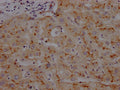IHC image of CSB-RA993633A0HU diluted at 1:100 and staining in paraffin-embedded human liver tissue performed on a Leica BondTM system. After dewaxing and hydration, antigen retrieval was mediated by high pressure in a citrate buffer (pH 6.0) . Section was blocked with 10% normal goat serum 30min at RT. Then primary antibody (1% BSA) was incubated at 4℃ overnight. The primary is detected by a Goat anti-rabbit IgG polymer labeled by HRP and visualized using 0.05% DAB.