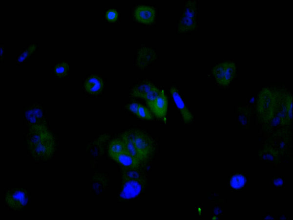 Immunofluorescence staining of MCF-7 cell with CSB-RA993982A0HU at 1:50, counter-stained with DAPI. The cells were fixed in 4% formaldehyde, permeabilized using 0.2% Triton X-100 and blocked in 10% normal Goat Serum. The cells were then incubated with the antibody overnight at 4°C. The secondary antibody was Alexa Fluor 488-congugated AffiniPure Goat Anti-Rabbit IgG(H+L) .