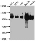 Western Blot
Positive WB detected in: Hela whole cell lysate, A375 whole cell lysate, HEK293 whole cell lysate, Rat Brain whole cell lysate, Mouse Brain whole cell lysate
All lanes: Amyloid beta A4 antibody at 1:1000
Secondary
Goat polyclonal to rabbit IgG at 1/50000 dilution
Predicted band size: 87, 35, 77, 79, 79, 81, 83, 85, 86, 73, 85 kDa
Observed band size: 100 kDa