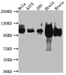 Western Blot
Positive WB detected in: Hela whole cell lysate, A375 whole cell lysate, HEK293 whole cell lysate, Rat Brain whole cell lysate, Mouse Brain whole cell lysate
All lanes: Amyloid beta A4 antibody at 1:1000
Secondary
Goat polyclonal to rabbit IgG at 1/50000 dilution
Predicted band size: 87, 35, 77, 79, 79, 81, 83, 85, 86, 73, 85 kDa
Observed band size: 100 kDa
