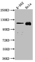 Western Blot
Positive WB detected in: K562 whole cell lysate, Hela whole cell lysate
All lanes: NUP98 antibody at 1:1000
Secondary
Goat polyclonal to rabbit IgG at 1/50000 dilution
Predicted band size: 198, 188, 98, 97, 196, 187 kDa
Observed band size: 100 kDa